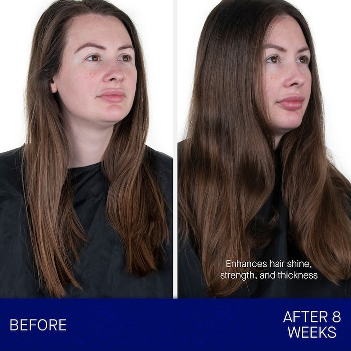 Augustinus Bader, The Conditioner