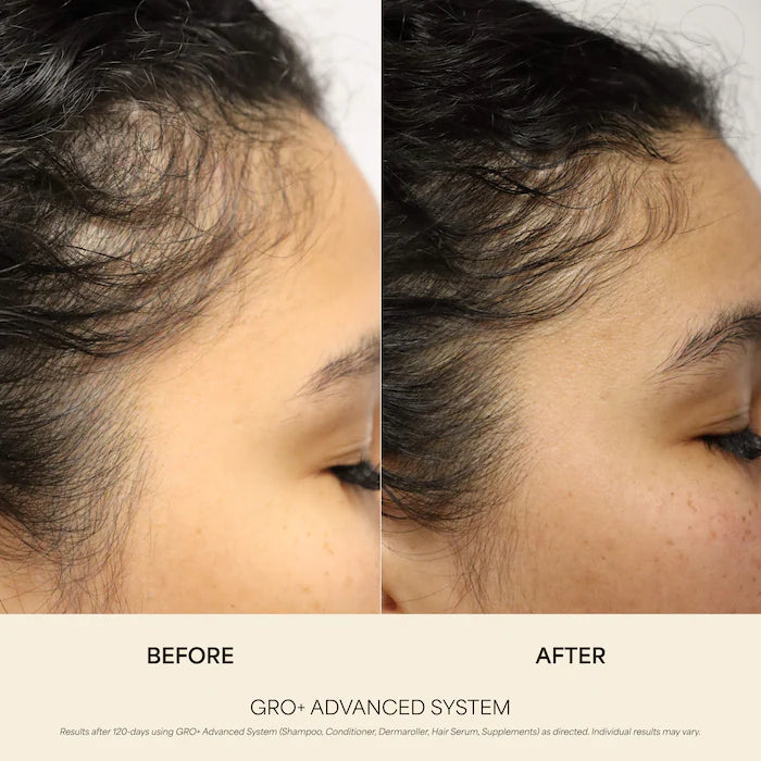 Vegamour GRO+ Advanced Growth Density Supplements for Hair Thinning and Loss