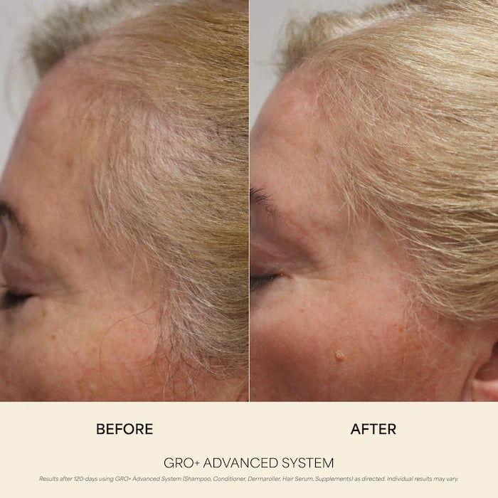 Vegamour GRO+ Advanced Growth Density Supplements for Hair Thinning and Loss