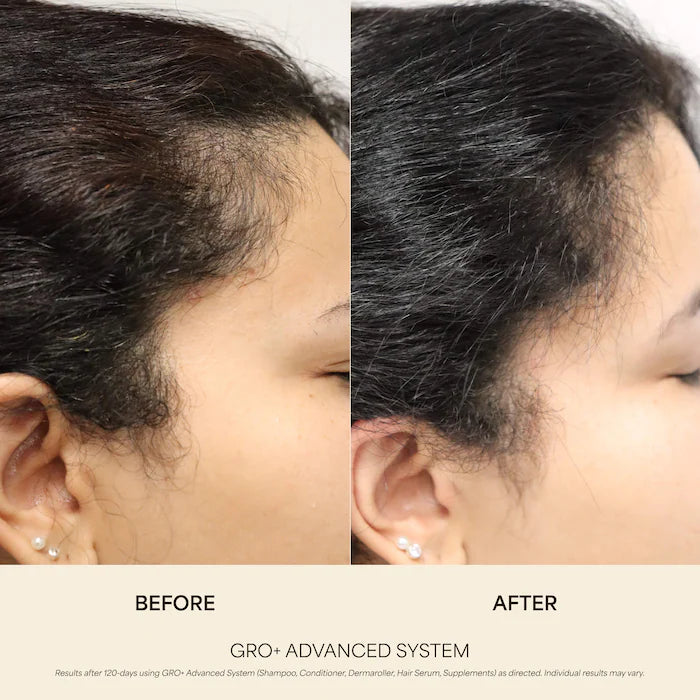 Vegamour GRO+ Advanced Growth Density Supplements for Hair Thinning and Loss