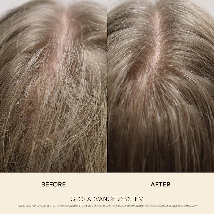 Vegamour GRO+ Advanced Growth Density Supplements for Hair Thinning and Loss