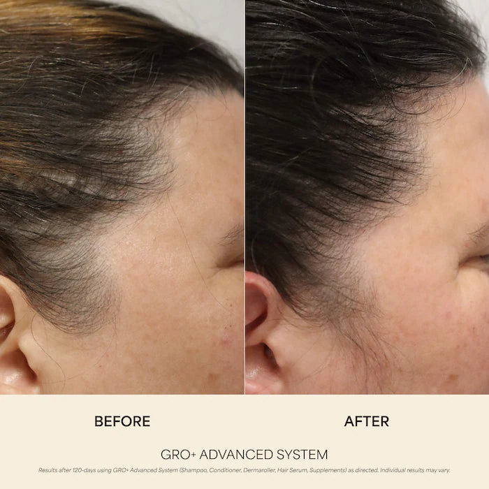 Vegamour GRO+ Advanced Growth Density Supplements for Hair Thinning and Loss