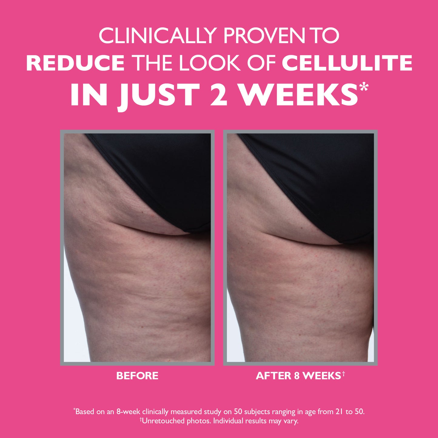 Peter Thomas Roth FIRMx tight & Toned Cellulite Treatment
