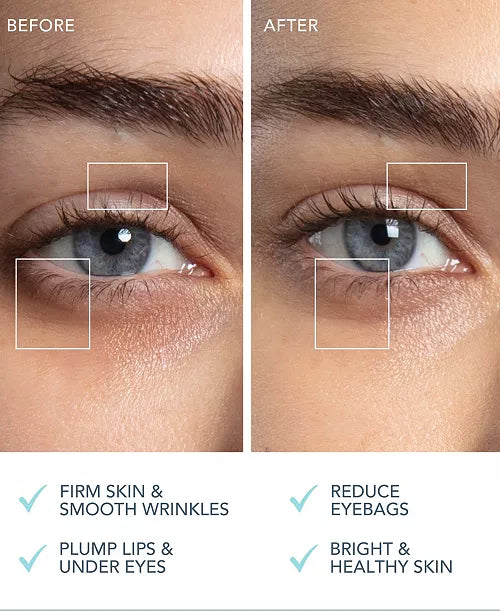 FOREO, BEAR 2 eyes lips Microcurrent Line Smoothing Device
