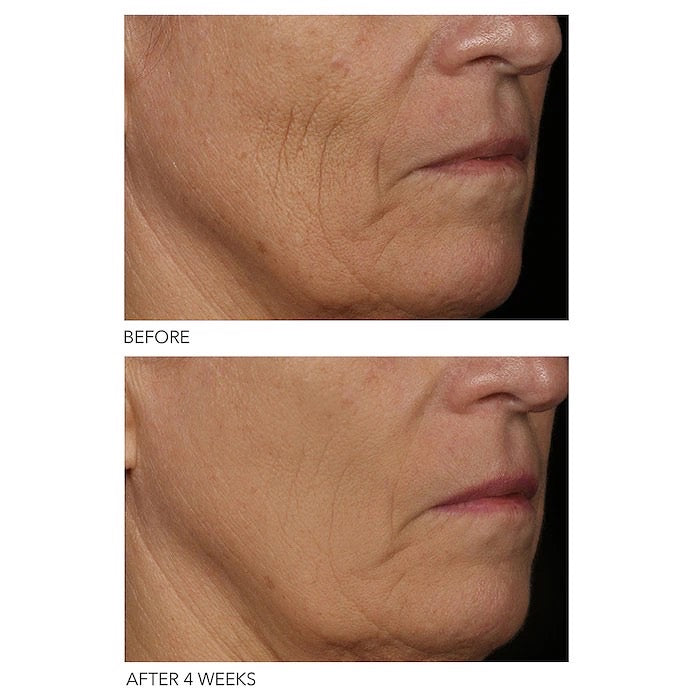 DR DENNIS GROSS SKINCARE, DRX SPECTRALITE FACEWARE PRO