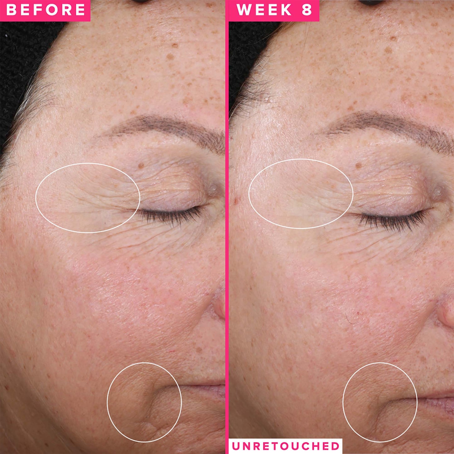 FARMACY, 1% VITAMIN A RETINOL SERUM