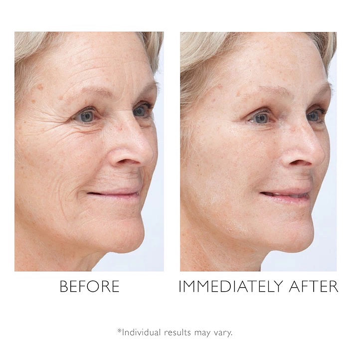 PETER THOMAS ROTH, INSTANT FIRMX TEMPORARY FACE TIGHTENER