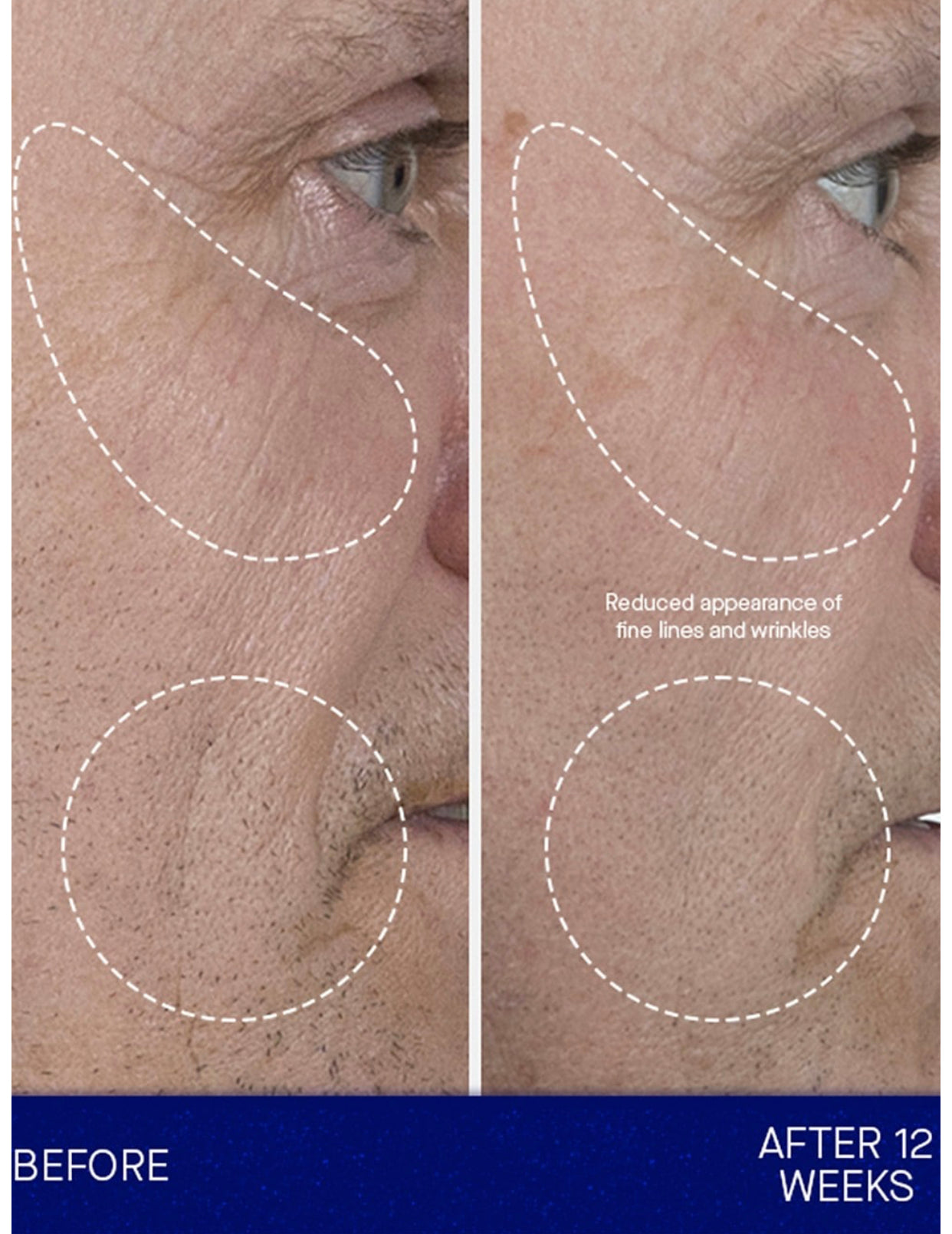 AUGUSTINUS BADER, NEW RELEASE!!! THE SERUM