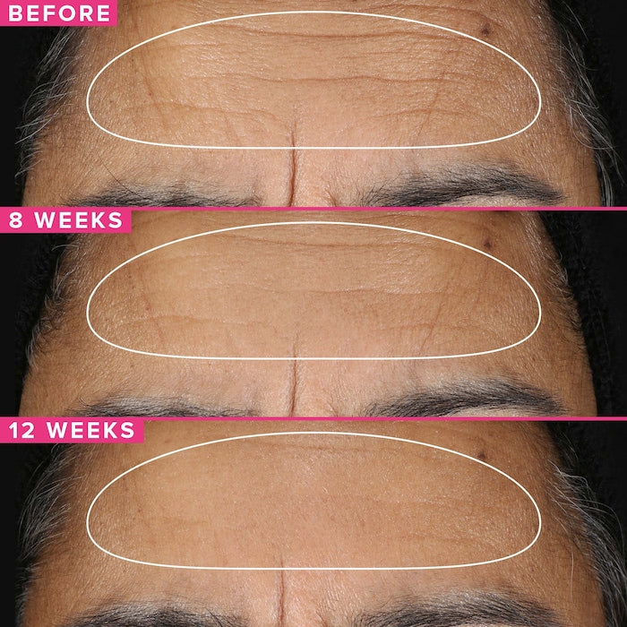 FARMACY, 1% VITAMIN A RETINOL SERUM