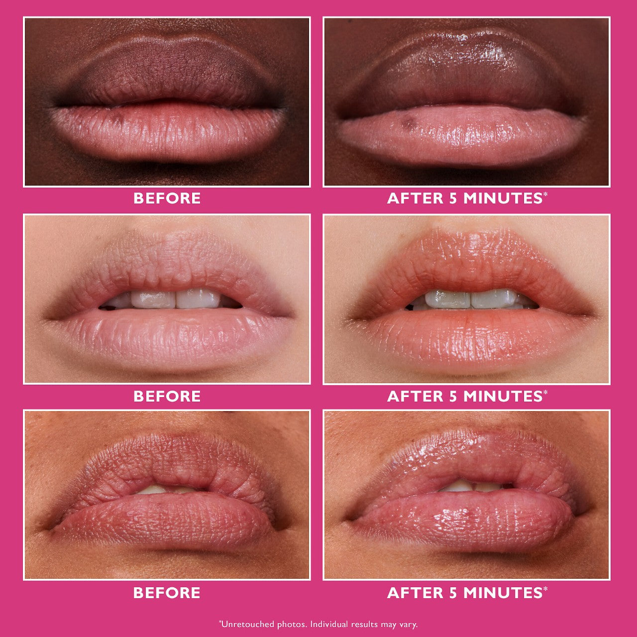 Peter Thomas Roth, Instant FIRMx Lip Filler