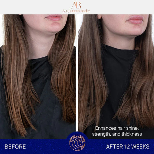 Augustinus Bader The Hair Treatment System