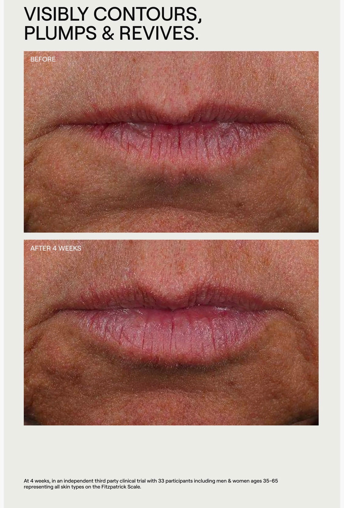 Dr. Diamond’s Metacine, LipLift Lip Serum