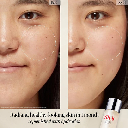 SK-II, PITERA First Experience Kit