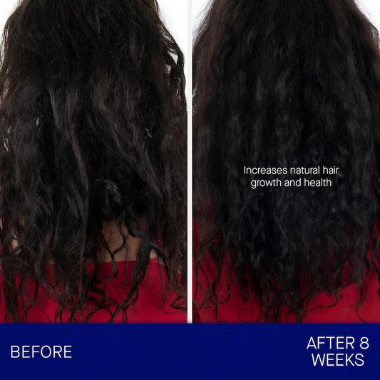 Augustinus Bader, The Conditioner