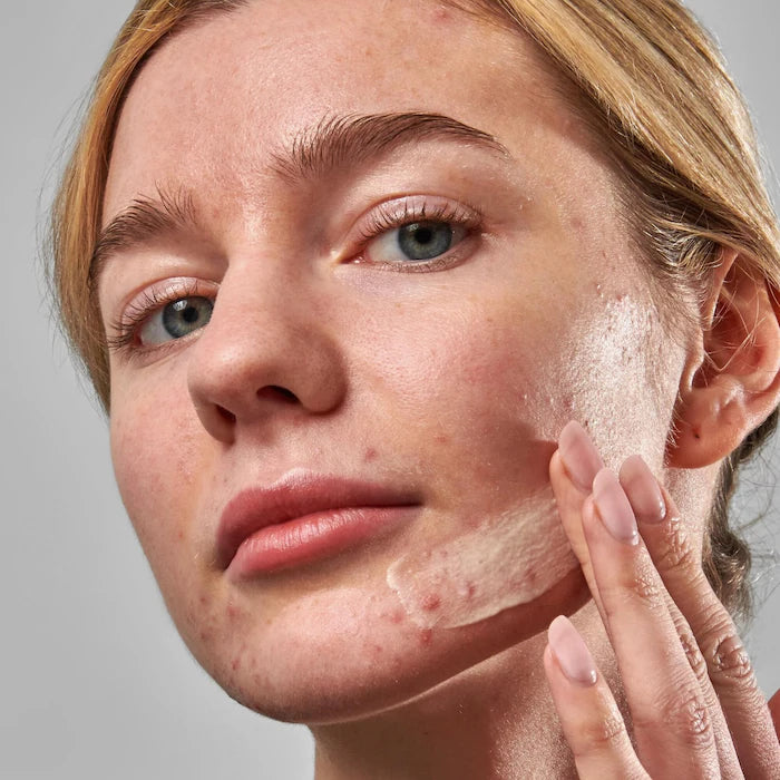 The INKEY List, SuperSolutions Acne Clearing Moisturizer 2% NOVORETIN ...