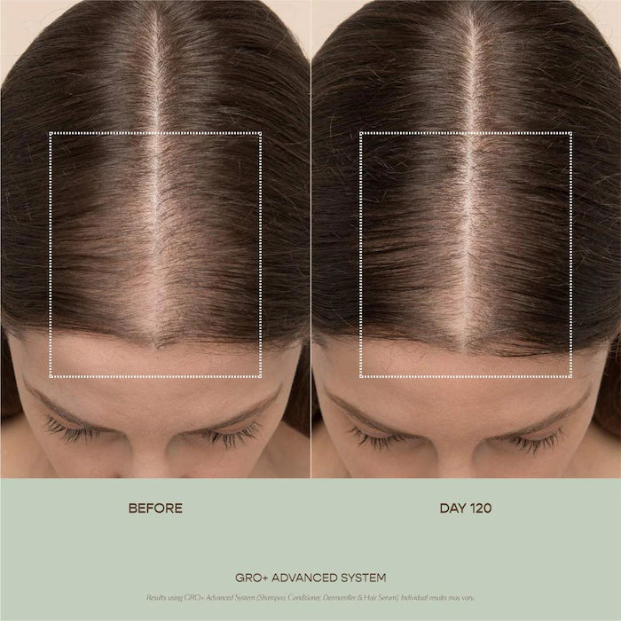 Vegamour GRO+ Advanced Hair Serum for Severe Signs of Thinning