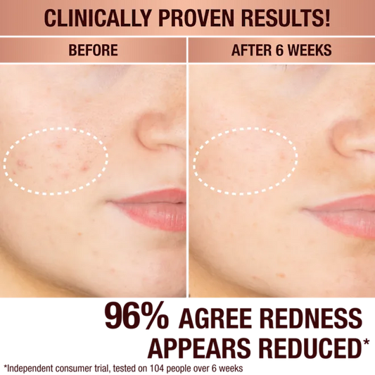 CHARLOTTE TILBURY, DARK SPOT CORRECTING RADIANCE RECOVERY SERUM 30 ML