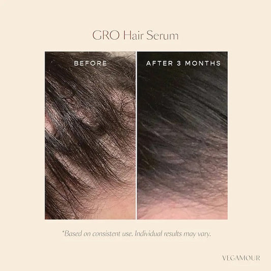 VEGAMOUR, GRO HAIR SERUM FOR THINING HAIR