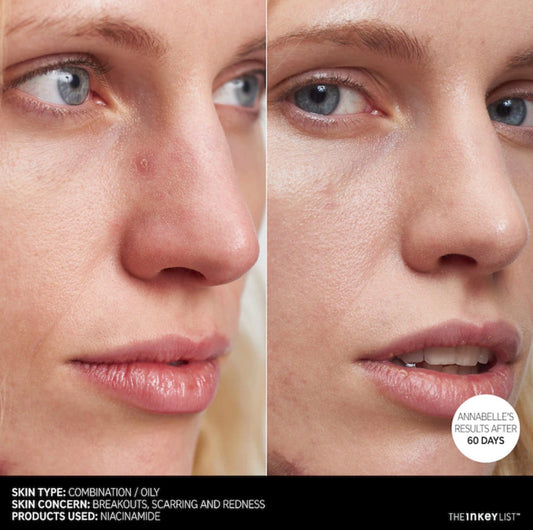 THE INKEY LIST NIACINAMIDE OIL CONTROL SERUM