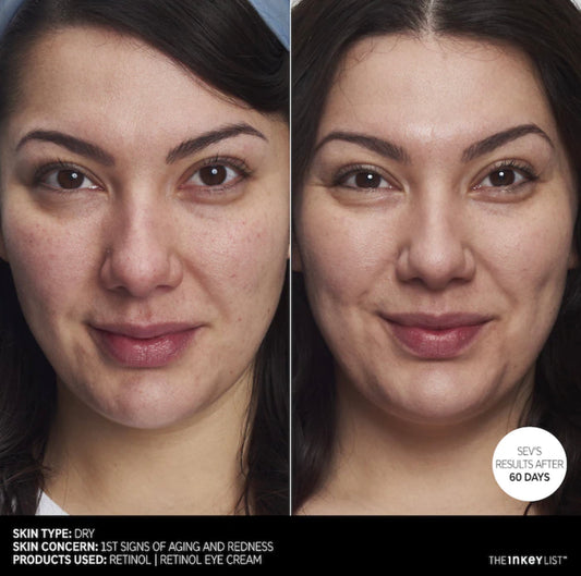 THE INKEY LIST RETINOL ANTI-AGING SERUM