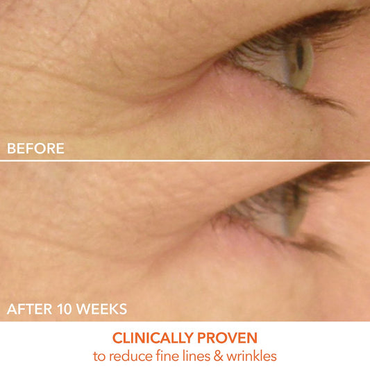 Dr. Dennis Gross Skincare DRx SpectraLite LED EyeCare Max Pro