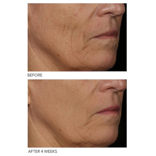 DR DENNIS GROSS SKINCARE, DRX SPECTRALITE FACEWARE PRO