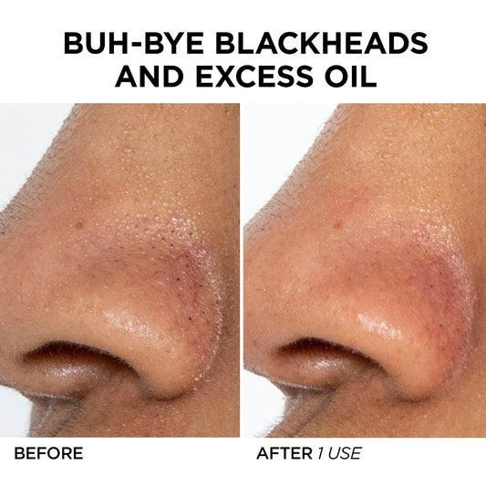 BeautyBio GLOfacial Hydro-Infusion Pore Cleansing + Blue LED Clarifying Tool