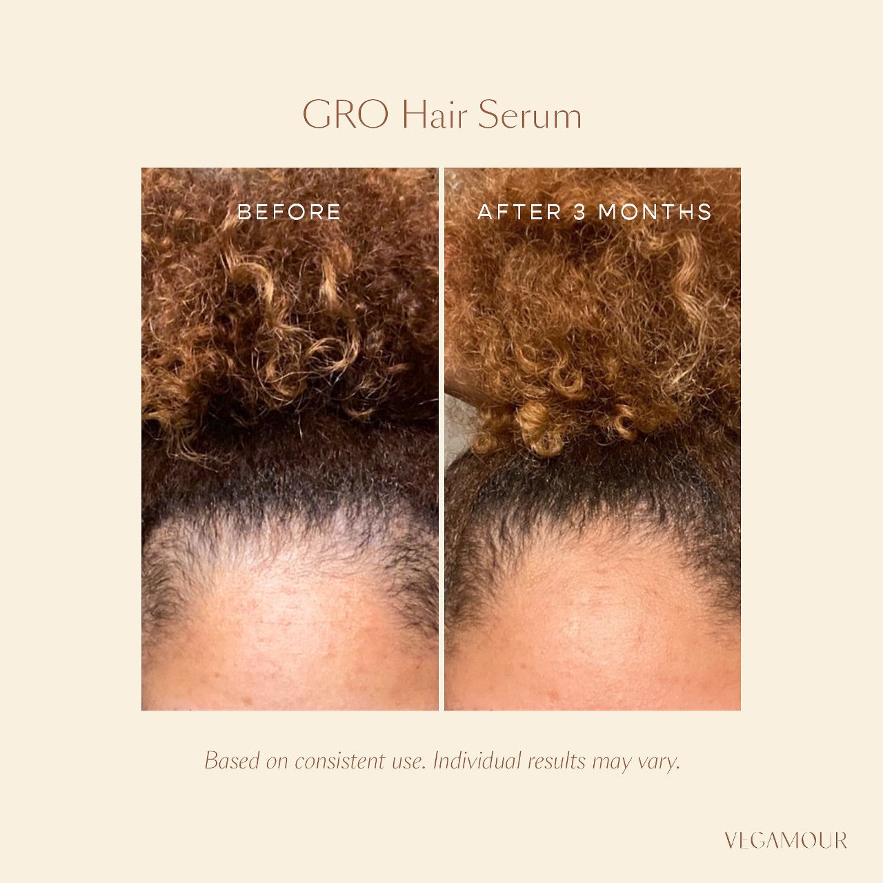 Vegamour GRO Healthy Hair Starter Set for Thinning Hair, GRO Hair Serum for Thinning Hair