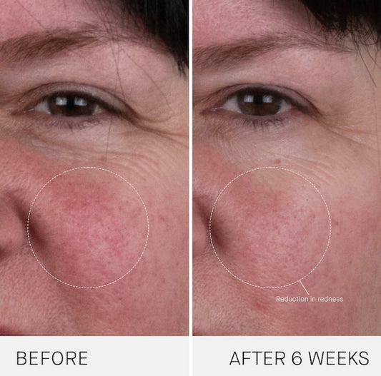 AUGUSTINUS BADER, THE RICH CREAM WITH TFC8 FACE MOISTURIZER