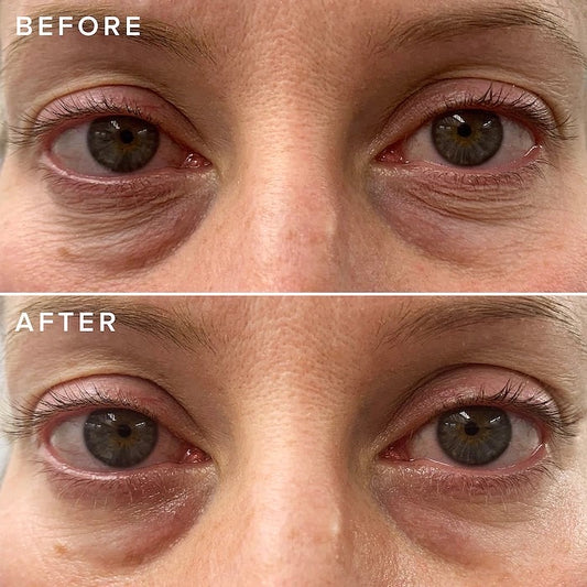 FARMACY, CHEER UP BRIGHTENING VITAMIN C EYE CREAM WITH ACEROLA CHERRY