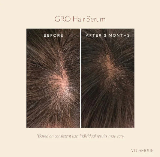 VEGAMOUR, GRO ESSENTIALS KIT FOR THINNING HAIR