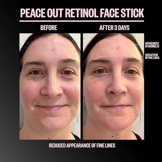 PEACE OUT, RETINOL FACE STICK